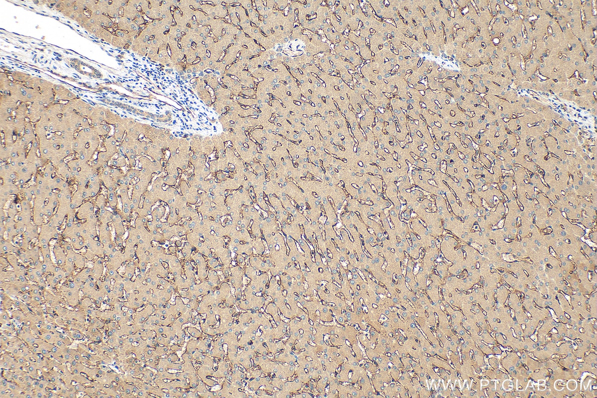 Immunohistochemistry (IHC) staining of human liver tissue using CD36 Polyclonal antibody (18836-1-AP)