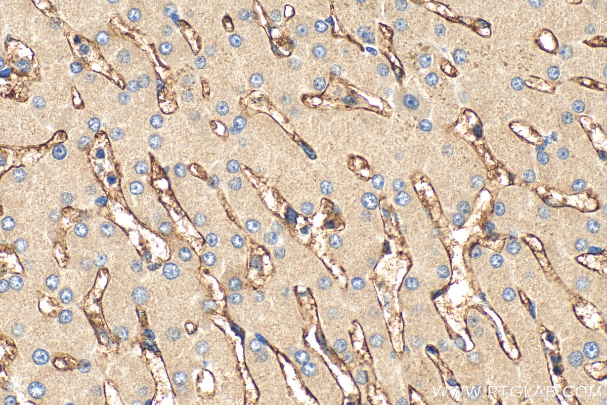 Immunohistochemistry (IHC) staining of human liver tissue using CD36 Polyclonal antibody (18836-1-AP)