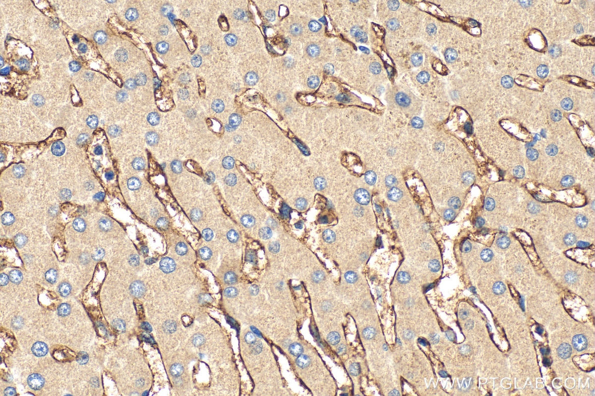 IHC staining of human liver using 18836-1-AP