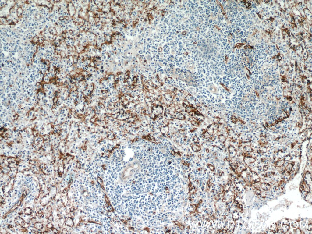 CD36 Polyclonal antibody