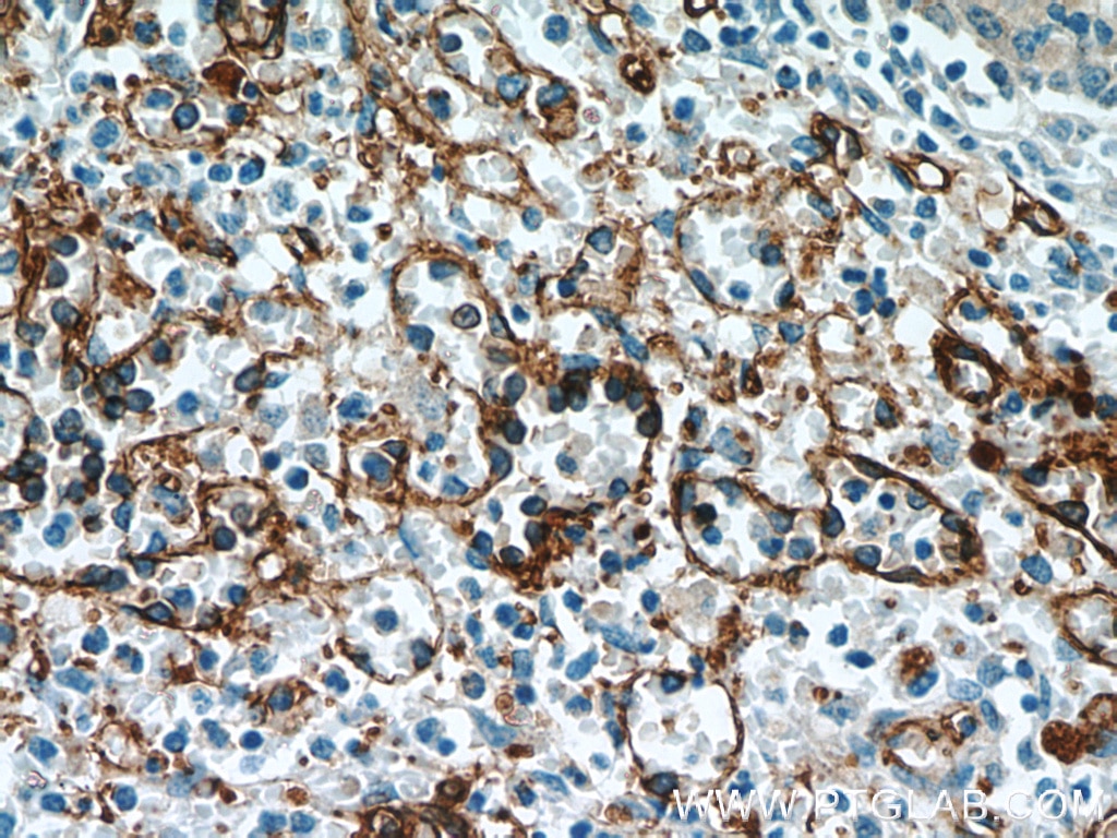 Immunohistochemistry (IHC) staining of human spleen tissue using CD36 Polyclonal antibody (18836-1-AP)