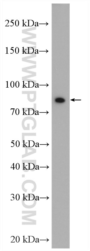 Western Blot (WB) analysis of HepG2 cells using CD36 Polyclonal antibody (18836-1-AP)