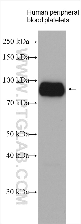 Western Blot (WB) analysis of various lysates using CD36 Polyclonal antibody (18836-1-AP)