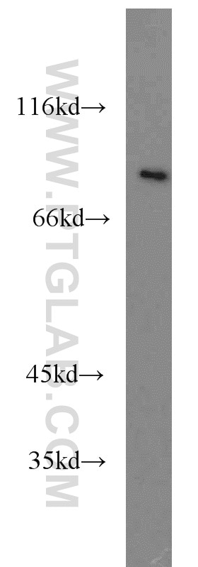 CD36 Polyclonal antibody