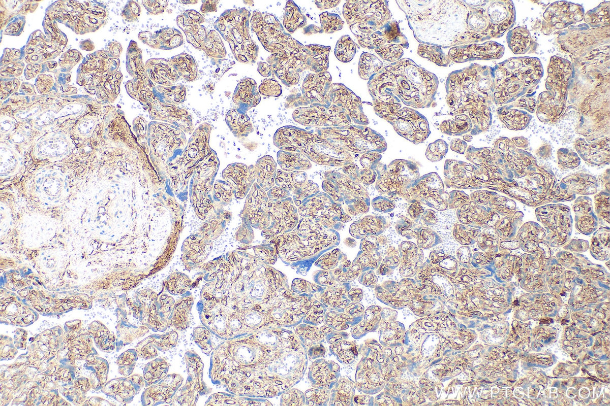 Immunohistochemistry (IHC) staining of human placenta tissue using CD36 Polyclonal antibody (32181-1-AP)