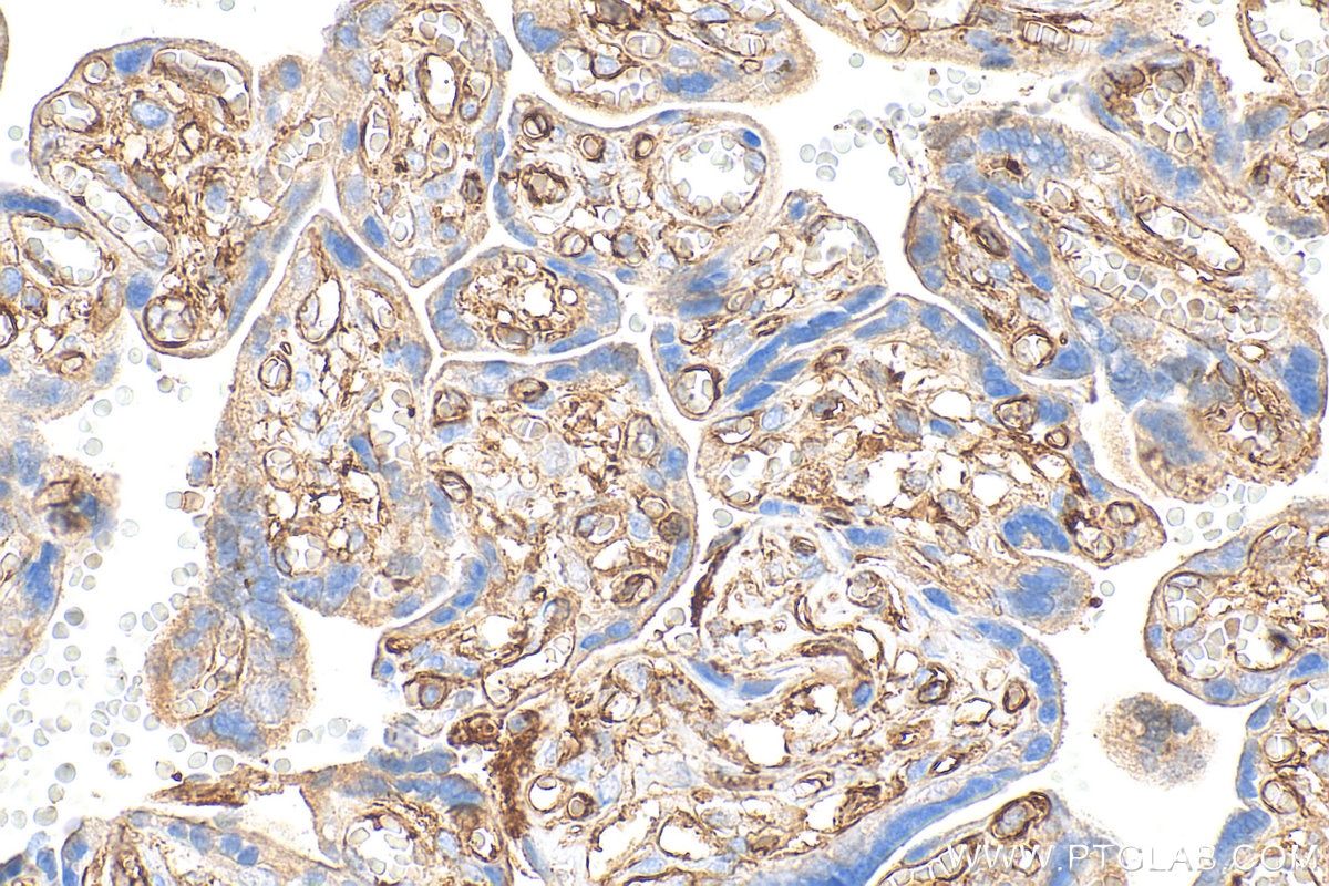 Immunohistochemistry (IHC) staining of human placenta tissue using CD36 Polyclonal antibody (32181-1-AP)