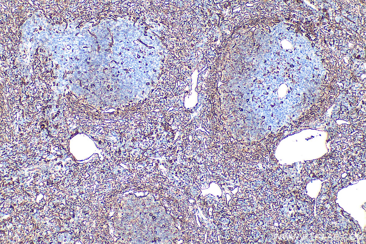 Immunohistochemistry (IHC) staining of mouse spleen tissue using CD36 Polyclonal antibody (32731-1-AP)
