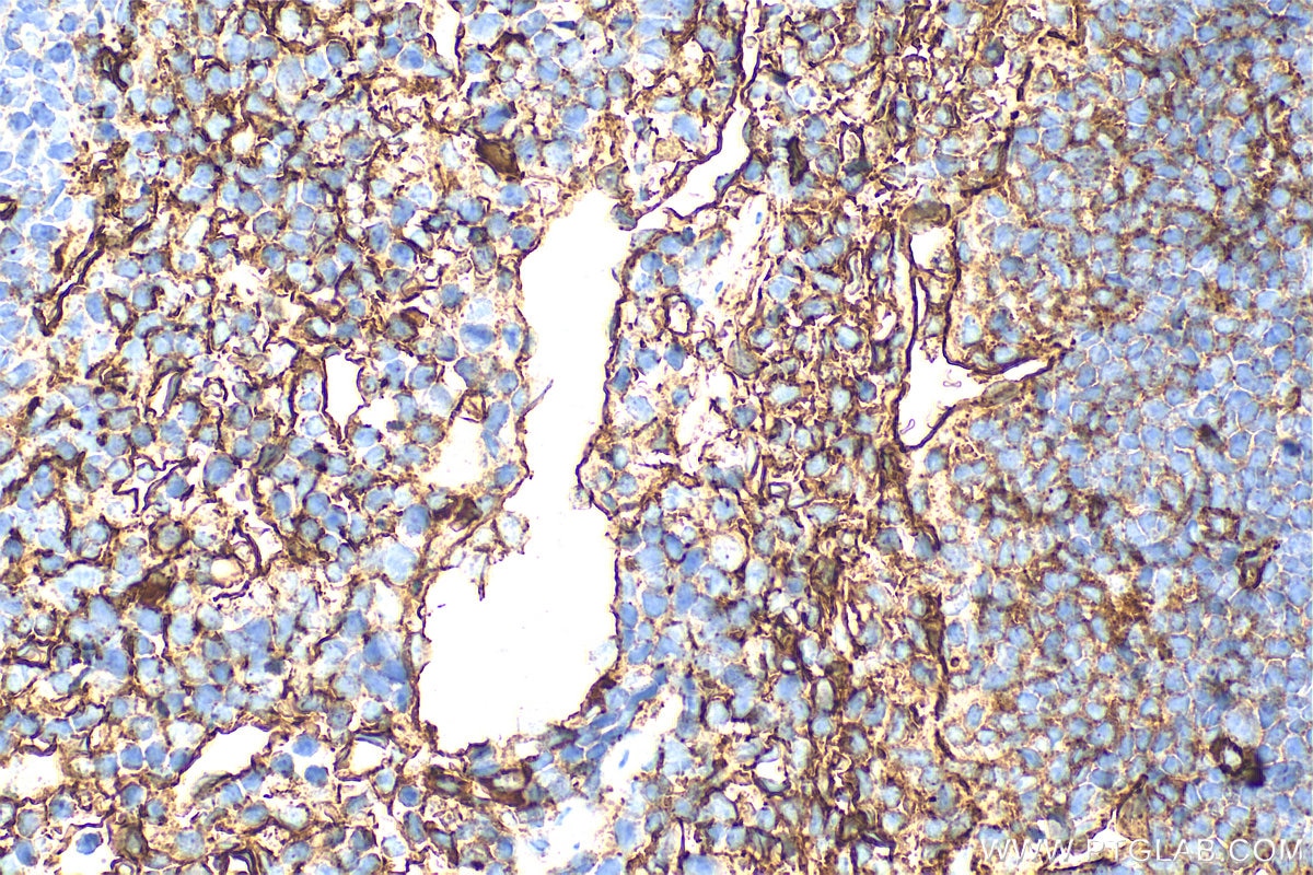 Immunohistochemistry (IHC) staining of mouse spleen tissue using CD36 Polyclonal antibody (32731-1-AP)