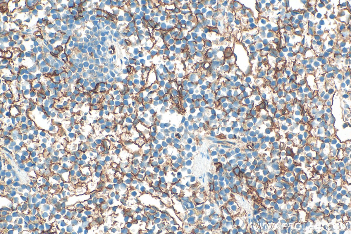 Immunohistochemical analysis of paraffin-embedded mouse spleen tissue slide using 32731-1-AP (CD36 antibody) at dilution of 1:2000 (under 40x lens). Heat mediated antigen retrieval with Tris-EDTA buffer (pH 9.0). Immunohistochemistry (IHC) staining of mouse spleen tissue using CD36 Polyclonal antibody (32731-1-AP)