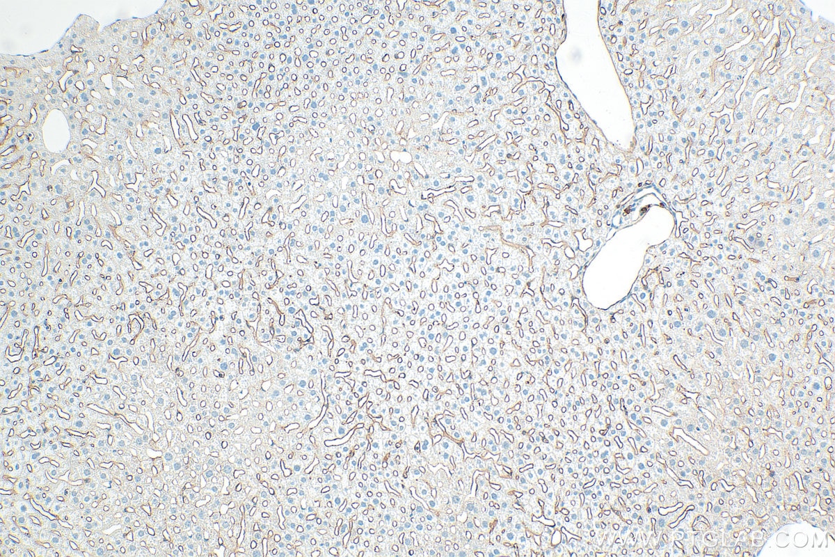 Immunohistochemical analysis of paraffin-embedded mouse liver tissue slide using 32731-1-AP (CD36 antibody) at dilution of 1:2000 (under 10x lens). Heat mediated antigen retrieval with Tris-EDTA buffer (pH 9.0). Immunohistochemistry (IHC) staining of mouse liver tissue using CD36 Polyclonal antibody (32731-1-AP)