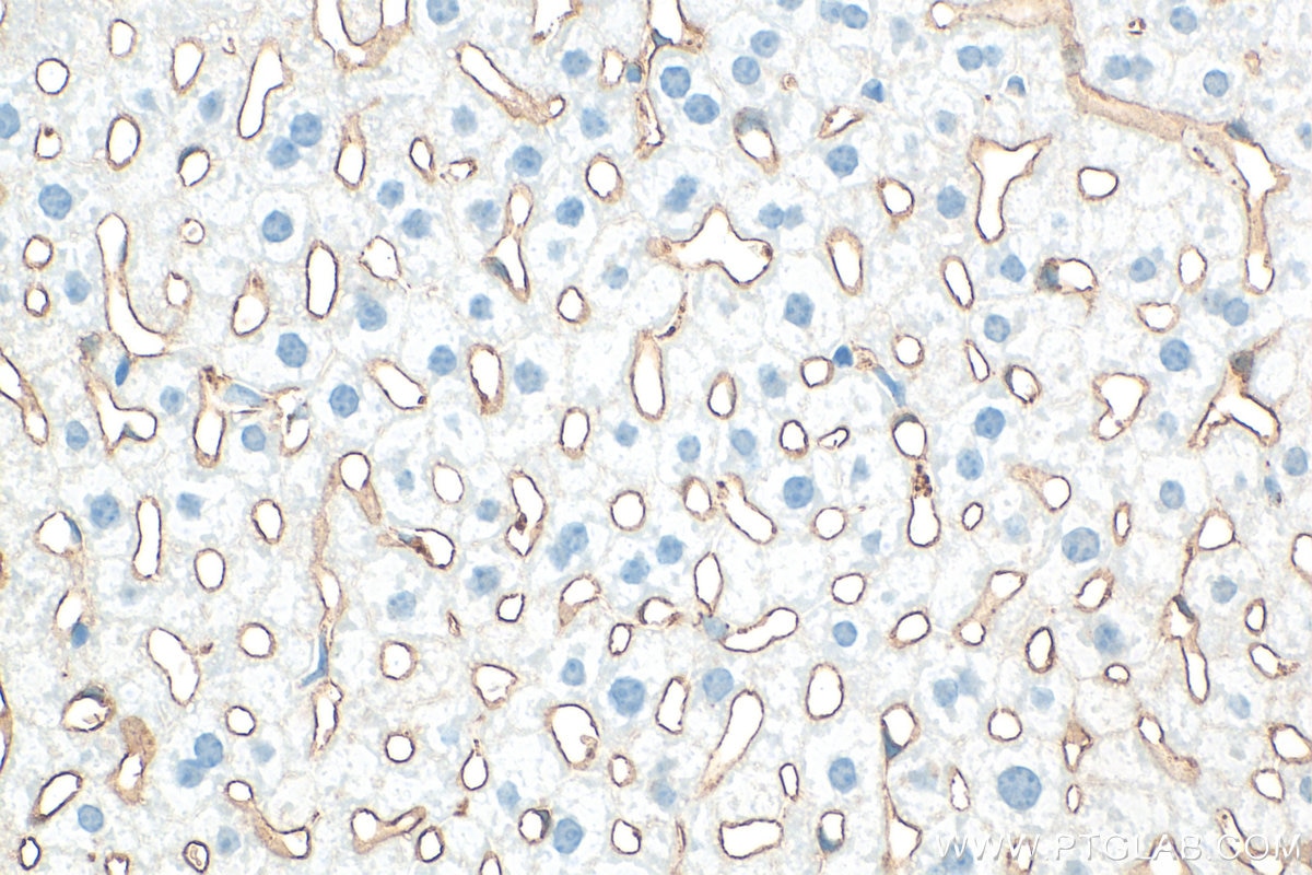 Immunohistochemical analysis of paraffin-embedded mouse liver tissue slide using 32731-1-AP (CD36 antibody) at dilution of 1:2000 (under 40x lens). Heat mediated antigen retrieval with Tris-EDTA buffer (pH 9.0). Immunohistochemistry (IHC) staining of mouse liver tissue using CD36 Polyclonal antibody (32731-1-AP)