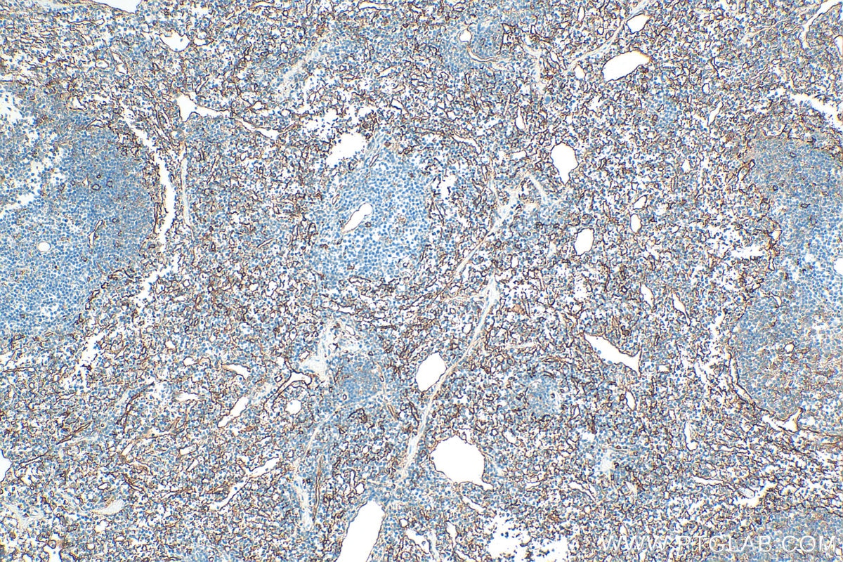 Immunohistochemical analysis of paraffin-embedded mouse spleen tissue slide using 32731-1-AP (CD36 antibody) at dilution of 1:2000 (under 10x lens). Heat mediated antigen retrieval with Tris-EDTA buffer (pH 9.0). Immunohistochemistry (IHC) staining of mouse spleen tissue using CD36 Polyclonal antibody (32731-1-AP)