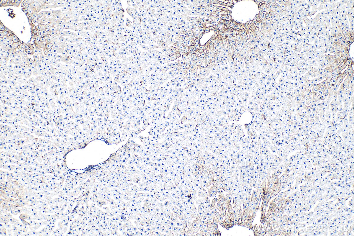 Immunohistochemistry (IHC) staining of rat liver tissue using CD36 Polyclonal antibody (32993-1-AP)
