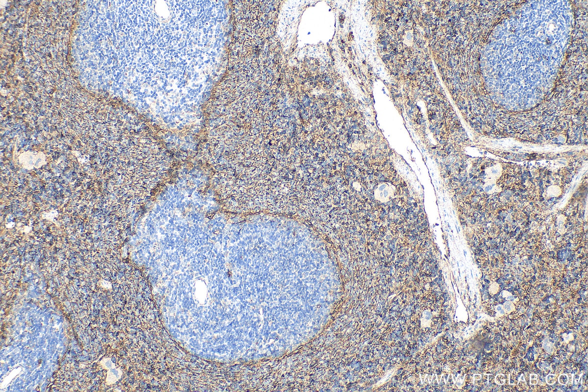 Immunohistochemistry (IHC) staining of rat spleen tissue using CD36 Polyclonal antibody (32993-1-AP)