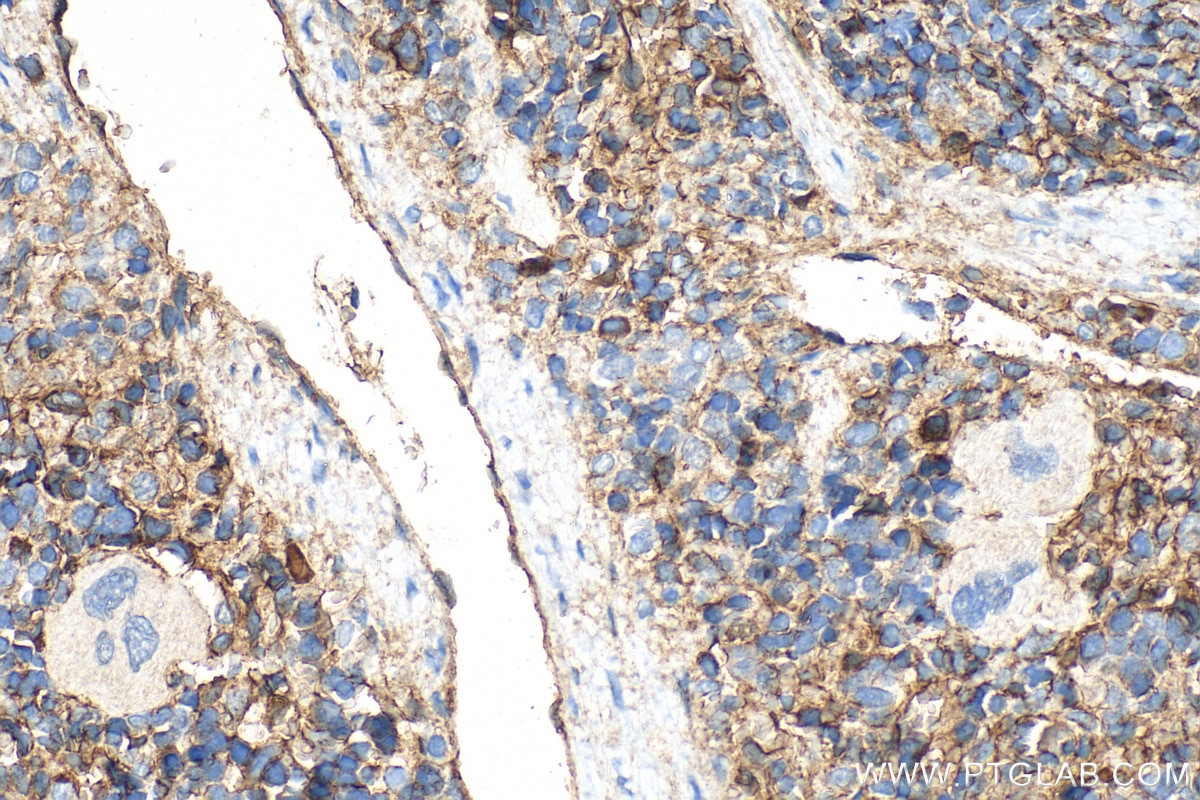 Immunohistochemistry (IHC) staining of rat spleen tissue using CD36 Polyclonal antibody (32993-1-AP)