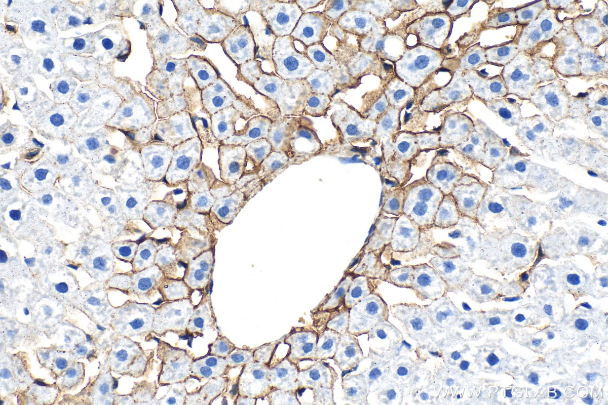 Immunohistochemistry (IHC) staining of rat liver tissue using CD36 Polyclonal antibody (32993-1-AP)