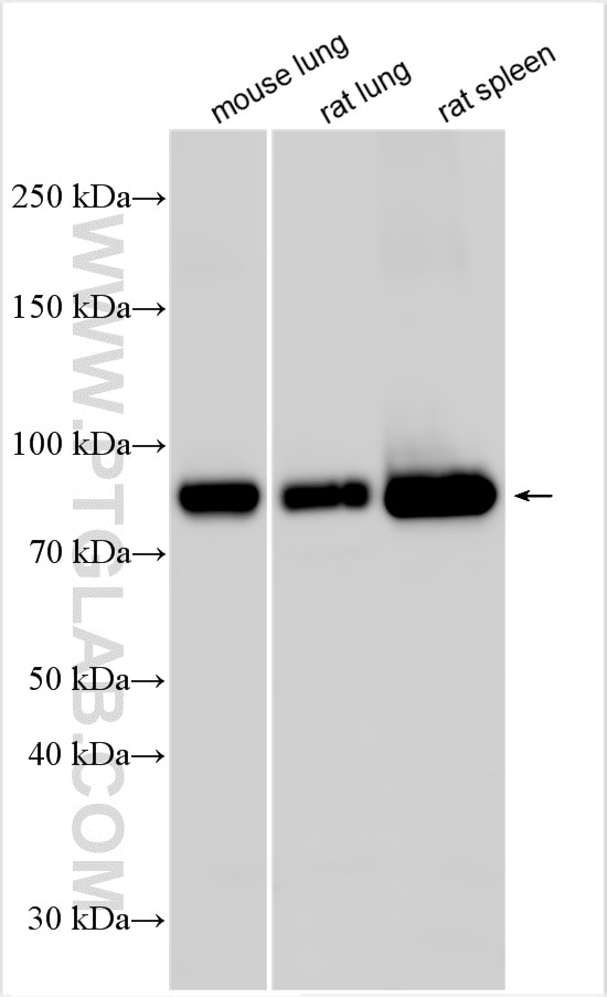 Western Blot (WB) analysis of various lysates using CD36 Polyclonal antibody (32993-1-AP)