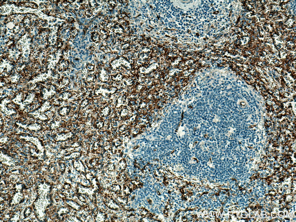 IHC staining of human spleen using 66395-1-Ig