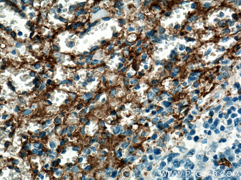 Immunohistochemistry (IHC) staining of human spleen tissue using CD36 Monoclonal antibody (66395-1-Ig)