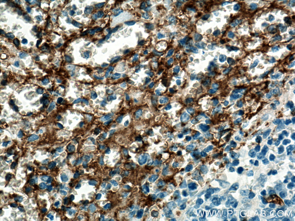 IHC staining of human spleen using 66395-1-Ig