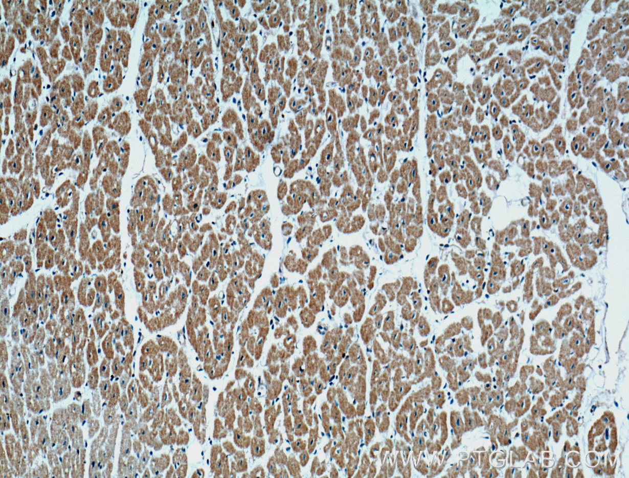 Immunohistochemistry (IHC) staining of human heart tissue using CD36 Monoclonal antibody (66395-1-Ig)