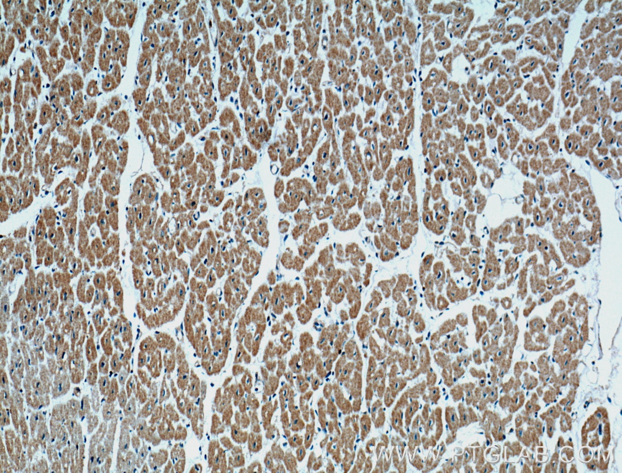 IHC staining of human heart using 66395-1-Ig