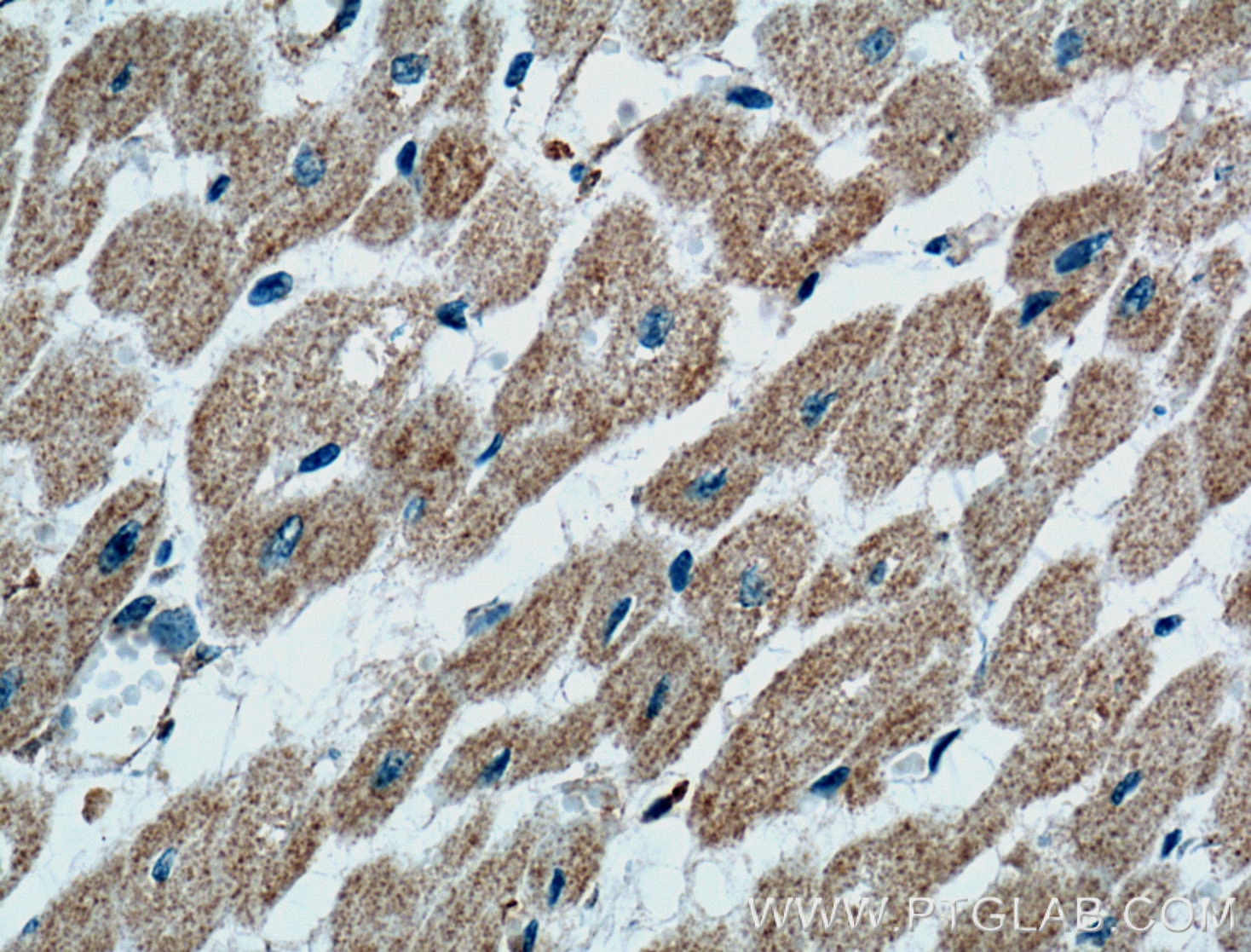 Immunohistochemistry (IHC) staining of human heart tissue using CD36 Monoclonal antibody (66395-1-Ig)