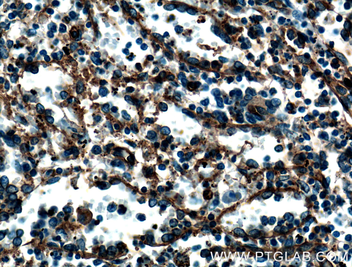 CD36 Monoclonal antibody