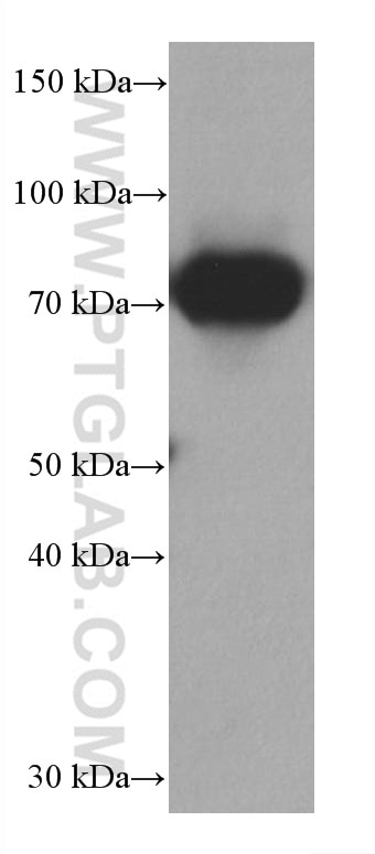 WB analysis of human milk using 66395-1-Ig