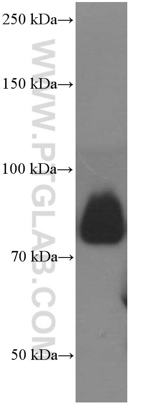 Western Blot (WB) analysis of human spleen tissue using CD36 Monoclonal antibody (66395-1-Ig)