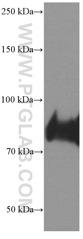 WB analysis of human placenta using 66395-1-Ig