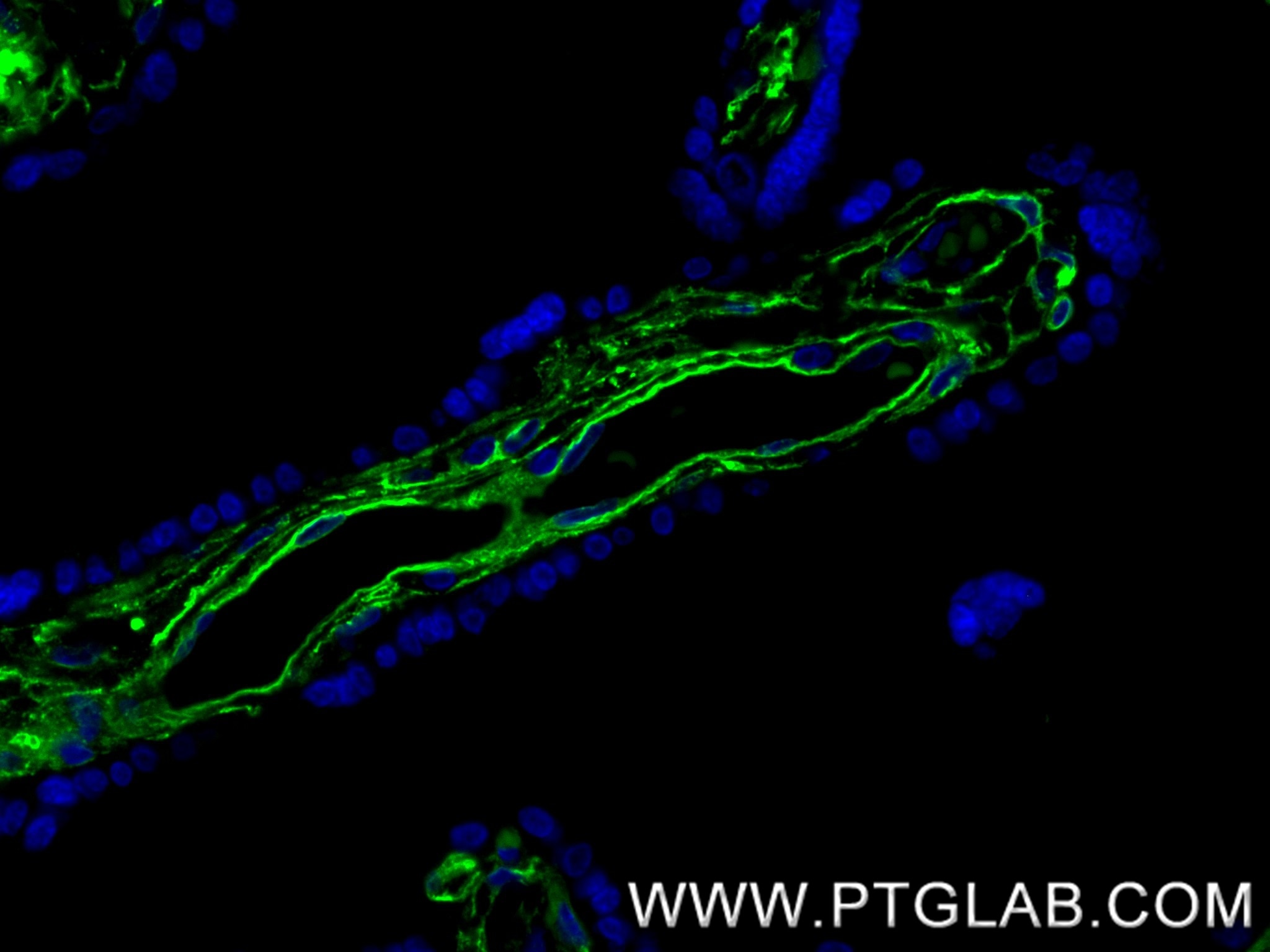 Immunofluorescence (IF) / fluorescent staining of human placenta tissue using CD36 Recombinant antibody (84078-4-RR)