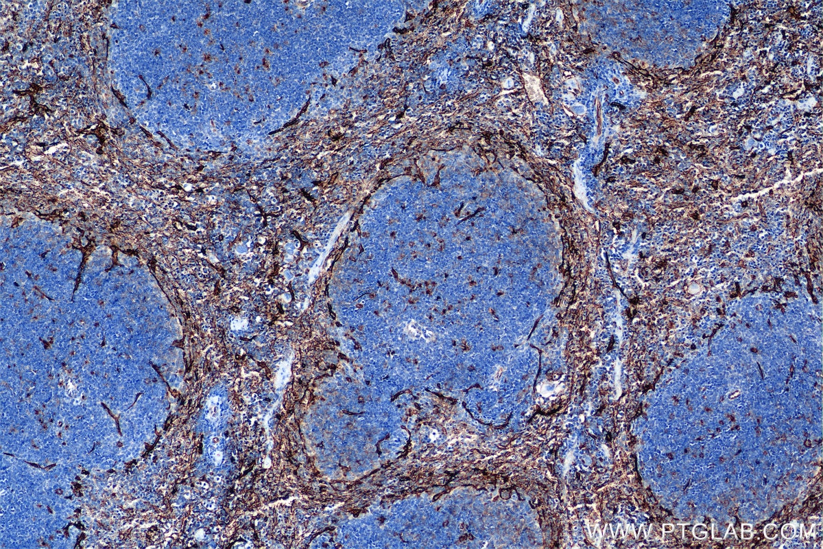 Immunohistochemistry (IHC) staining of mouse spleen tissue using CD36 Recombinant antibody (85127-5-RR)