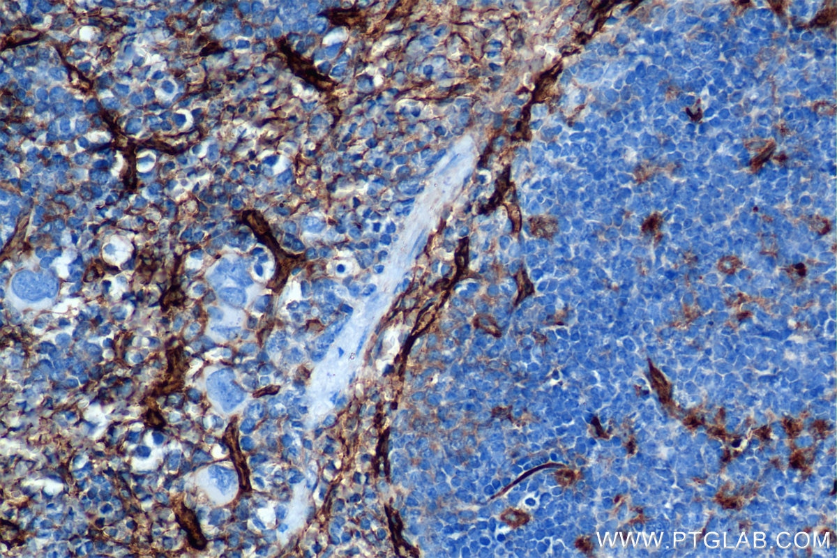 Immunohistochemistry (IHC) staining of mouse spleen tissue using CD36 Recombinant antibody (85127-5-RR)