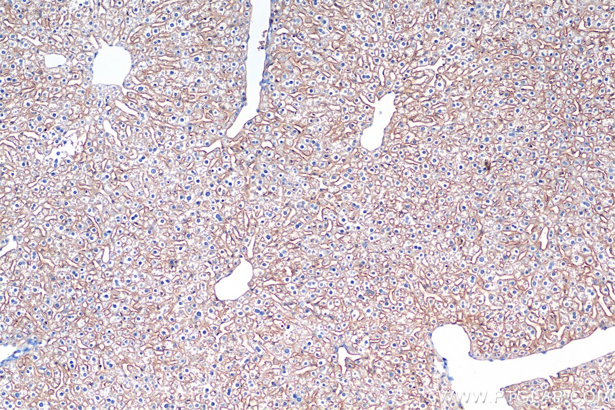 Immunohistochemistry (IHC) staining of mouse liver tissue using CD36 Recombinant antibody (85127-5-RR)