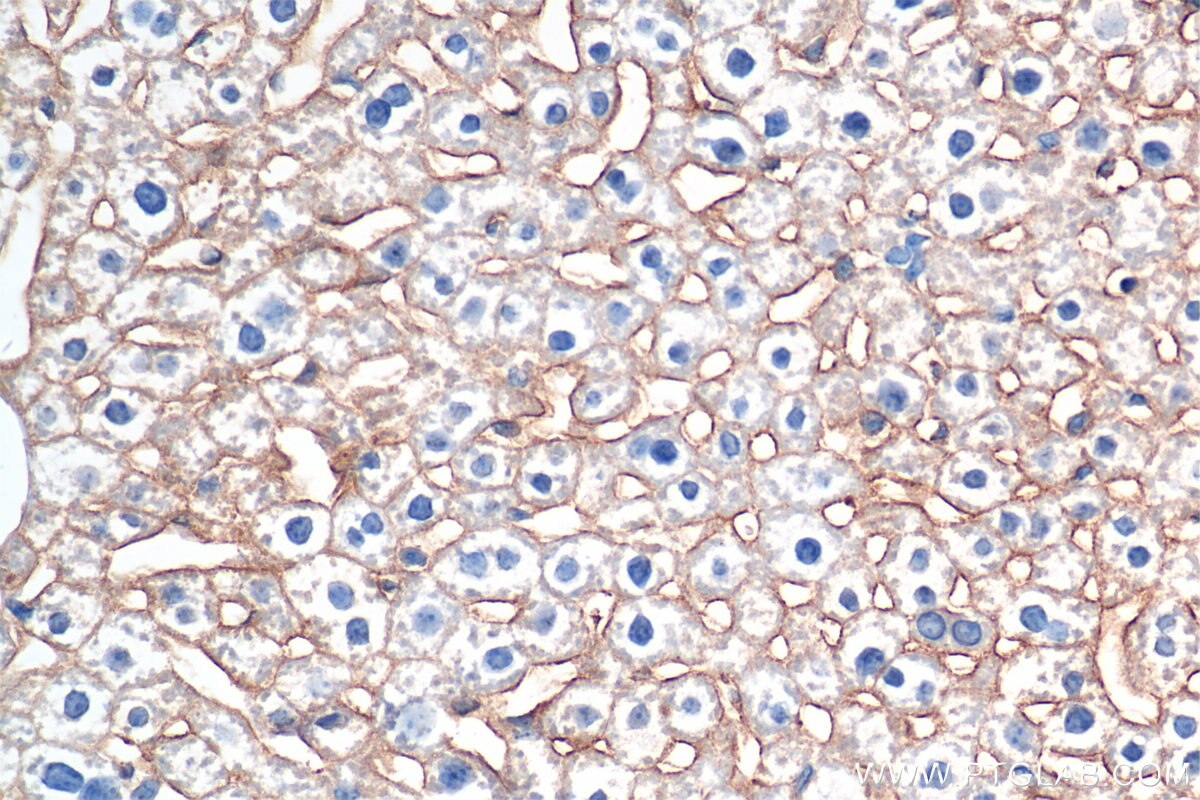 Immunohistochemistry (IHC) staining of mouse liver tissue using CD36 Recombinant antibody (85127-5-RR)