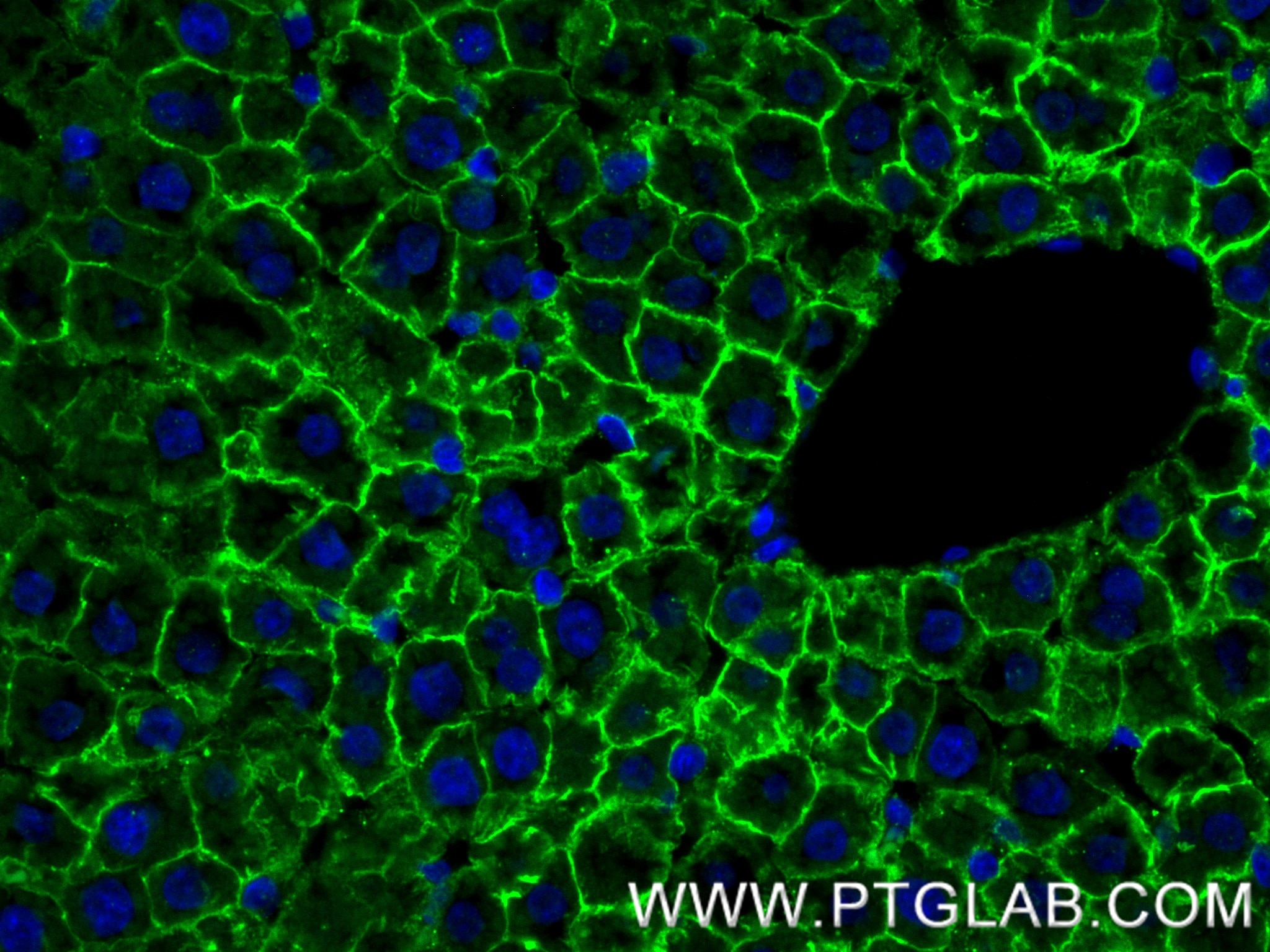 Immunofluorescence (IF) / fluorescent staining of rat liver tissue using CD36 Recombinant monoclonal antibody (86246-6-RR)