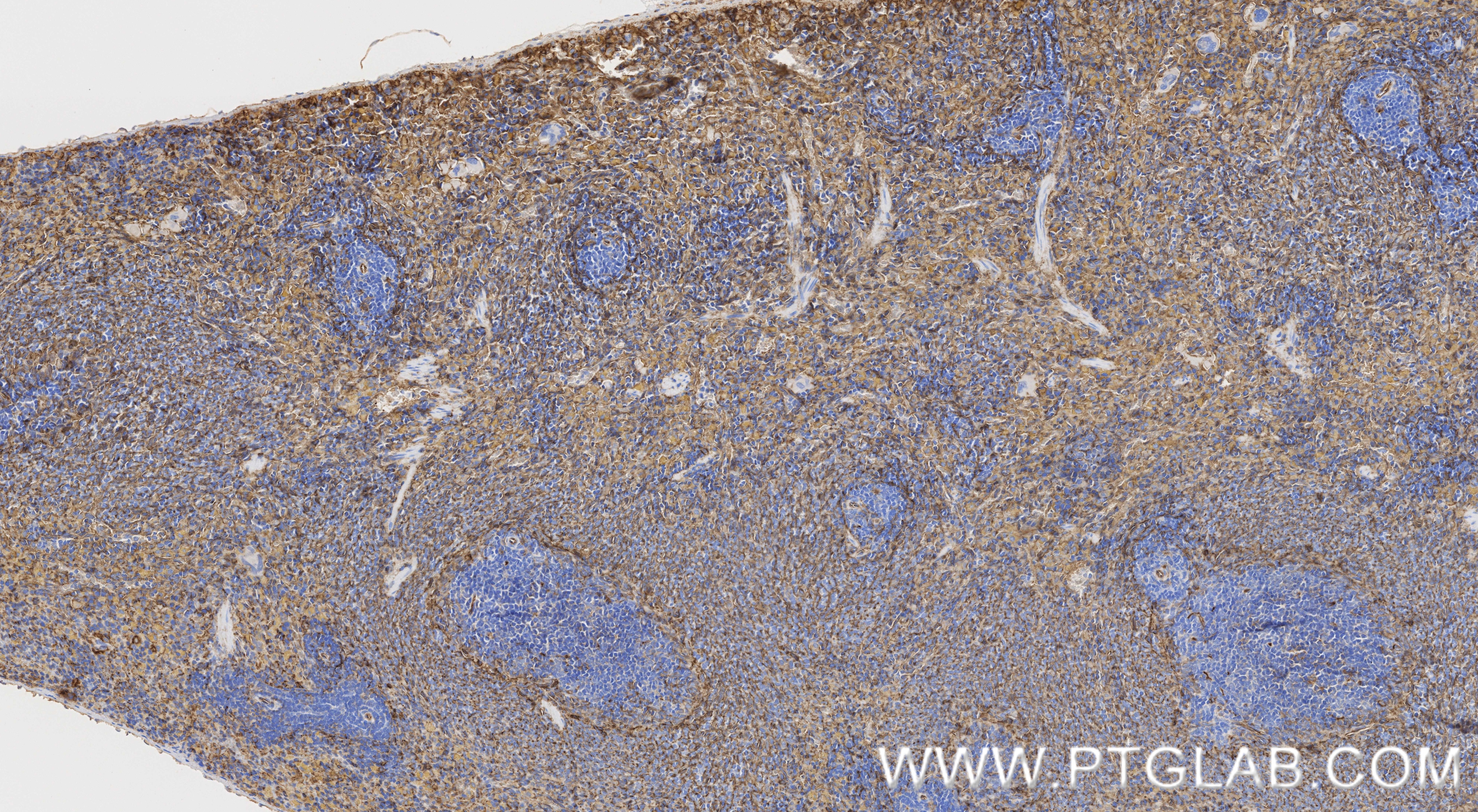 Immunohistochemistry (IHC) staining of rat spleen tissue using CD36 Recombinant monoclonal antibody (86246-6-RR)