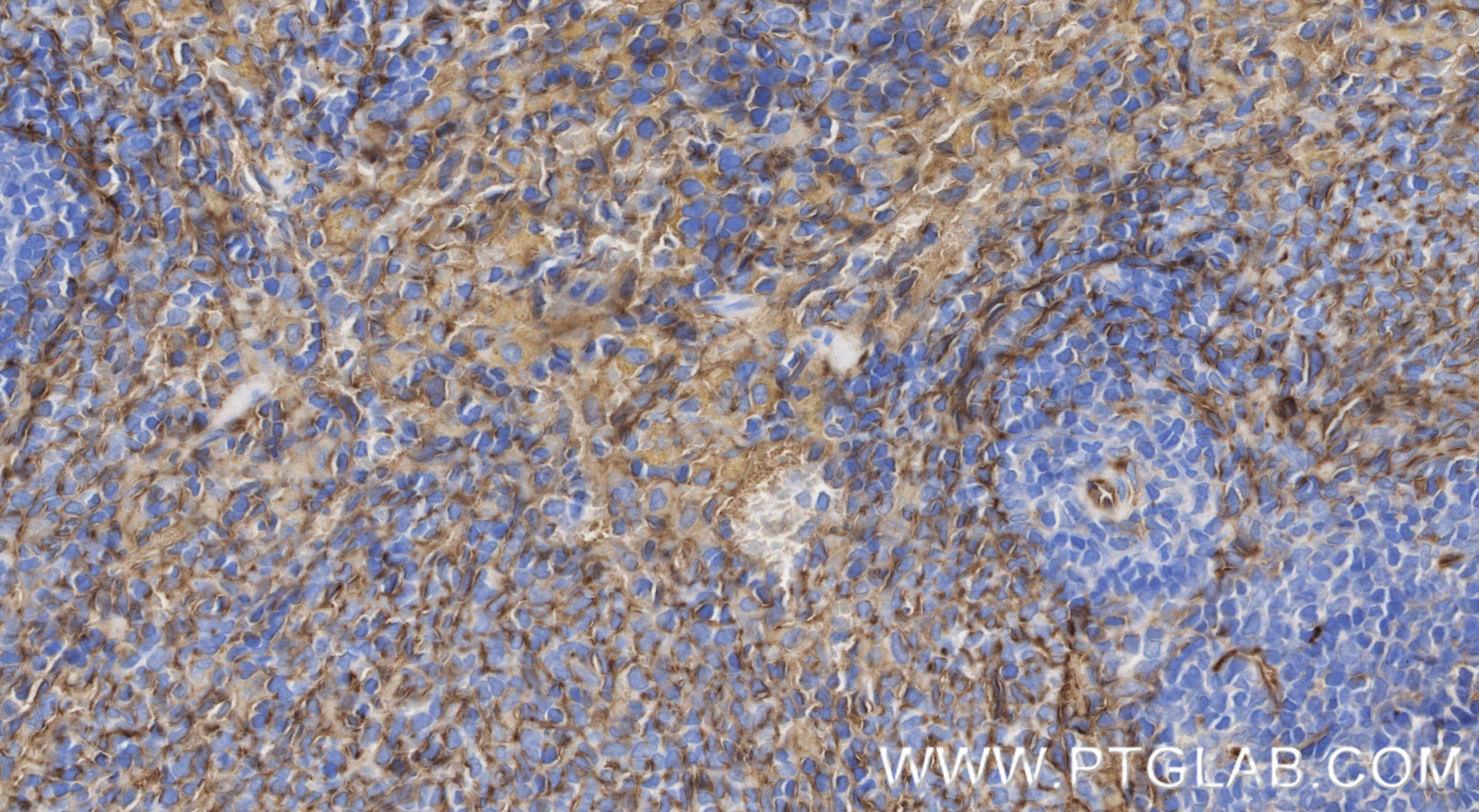 Immunohistochemistry (IHC) staining of rat spleen tissue using CD36 Recombinant monoclonal antibody (86246-6-RR)