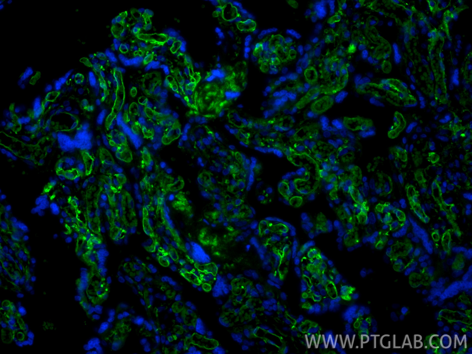 Immunofluorescence (IF) / fluorescent staining of human placenta tissue using CoraLite® Plus 488-conjugated CD36 Recombinant mon (CL488-84078-4)