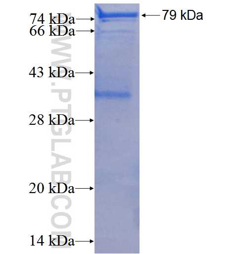 CD36 fusion protein Ag1857 SDS-PAGE