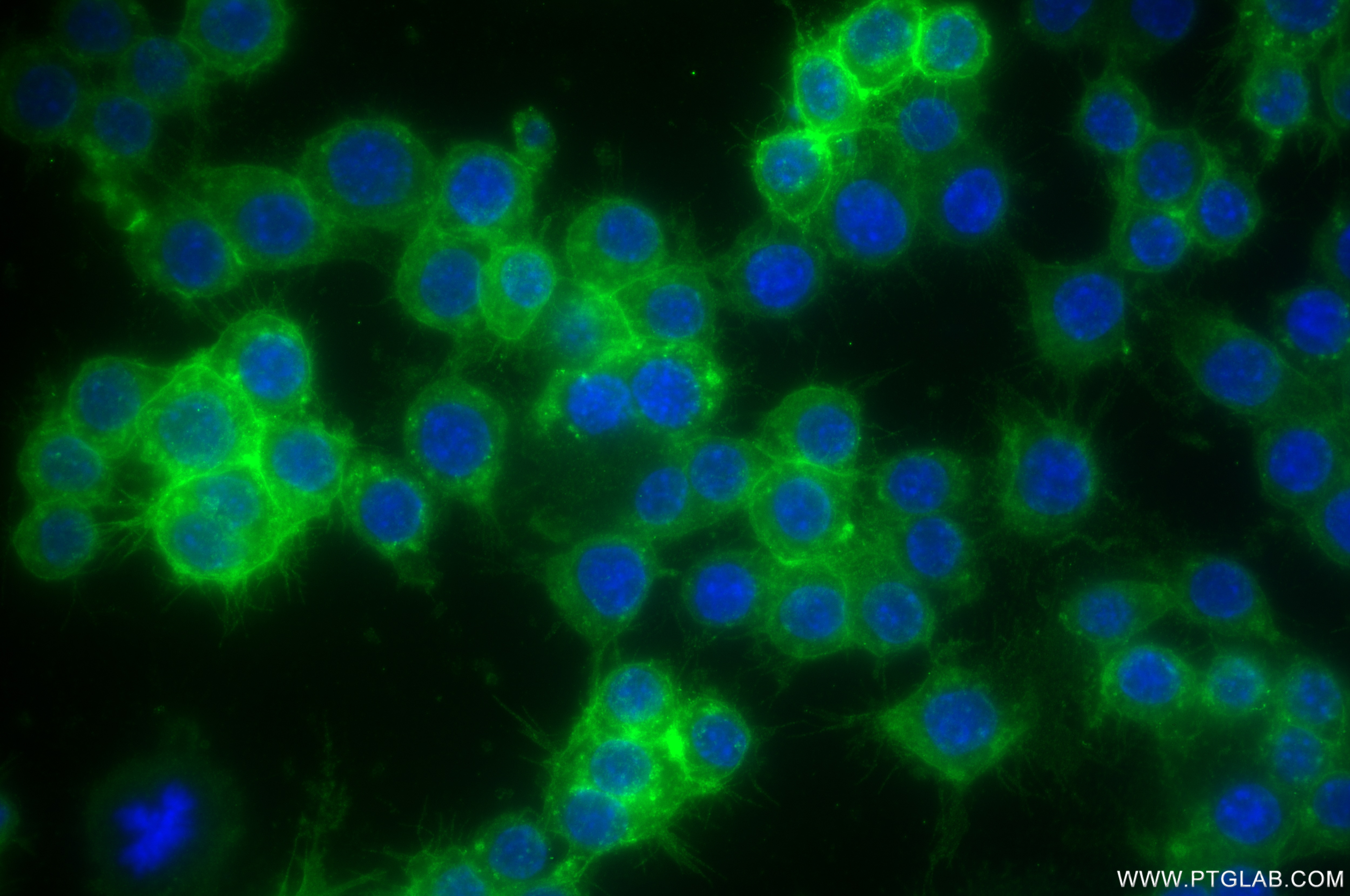 Immunofluorescence (IF) / fluorescent staining of RAW 264.7 cells using CD36 Recombinant antibody (85127-6-RR)