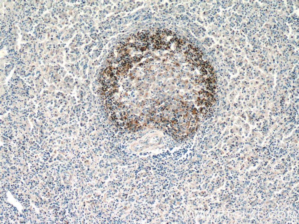 Immunohistochemistry (IHC) staining of human spleen tissue using CD37 Polyclonal antibody (21044-1-AP)