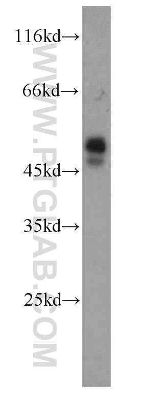 Western Blot (WB) analysis of human spleen tissue using CD37 Polyclonal antibody (21044-1-AP)