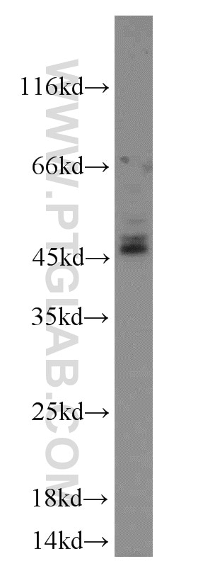 Western Blot (WB) analysis of HeLa cells using CD37 Polyclonal antibody (21044-1-AP)