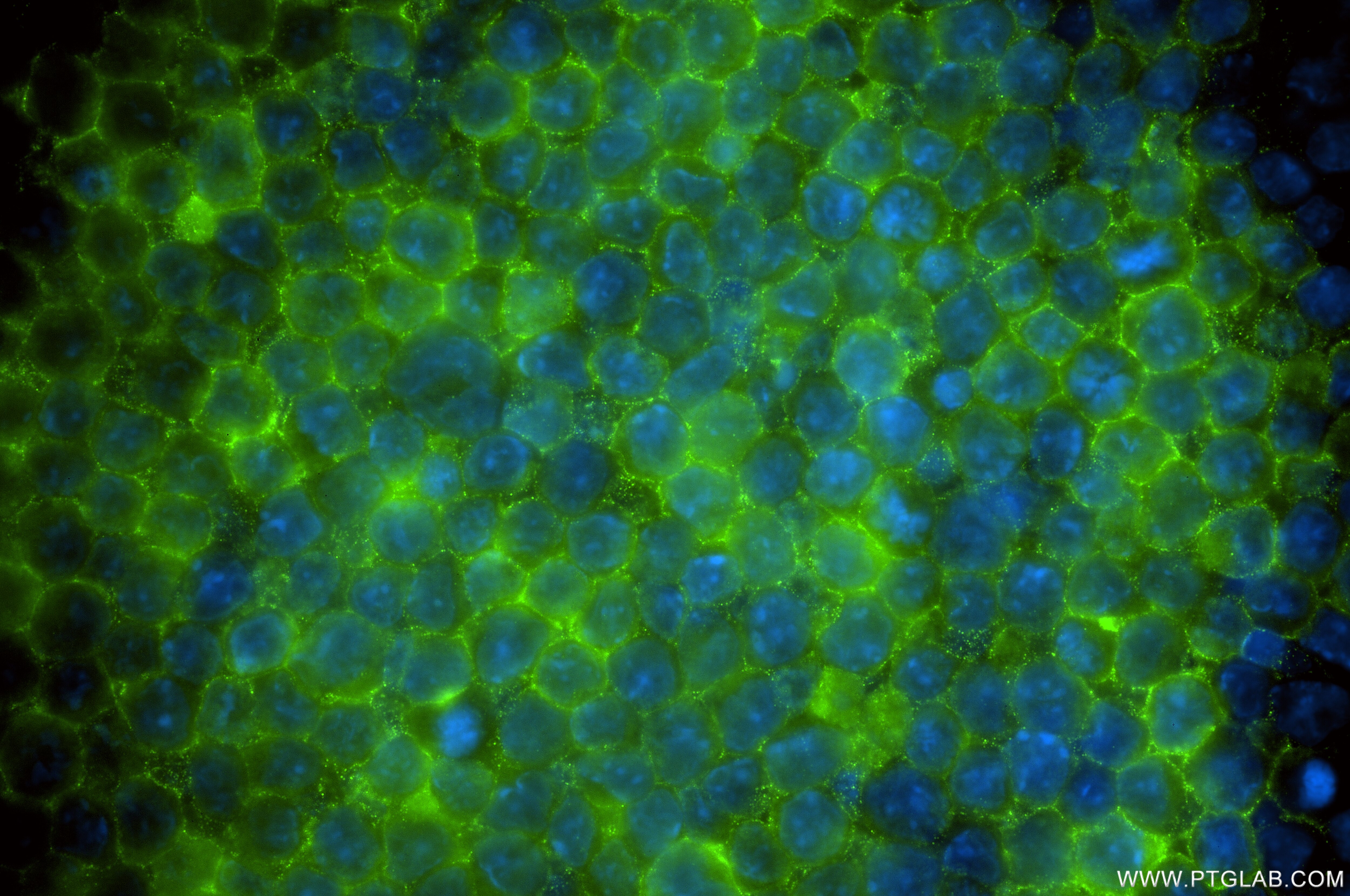 Immunofluorescence (IF) / fluorescent staining of A20 cells using CD37 Recombinant antibody (85917-1-RR)