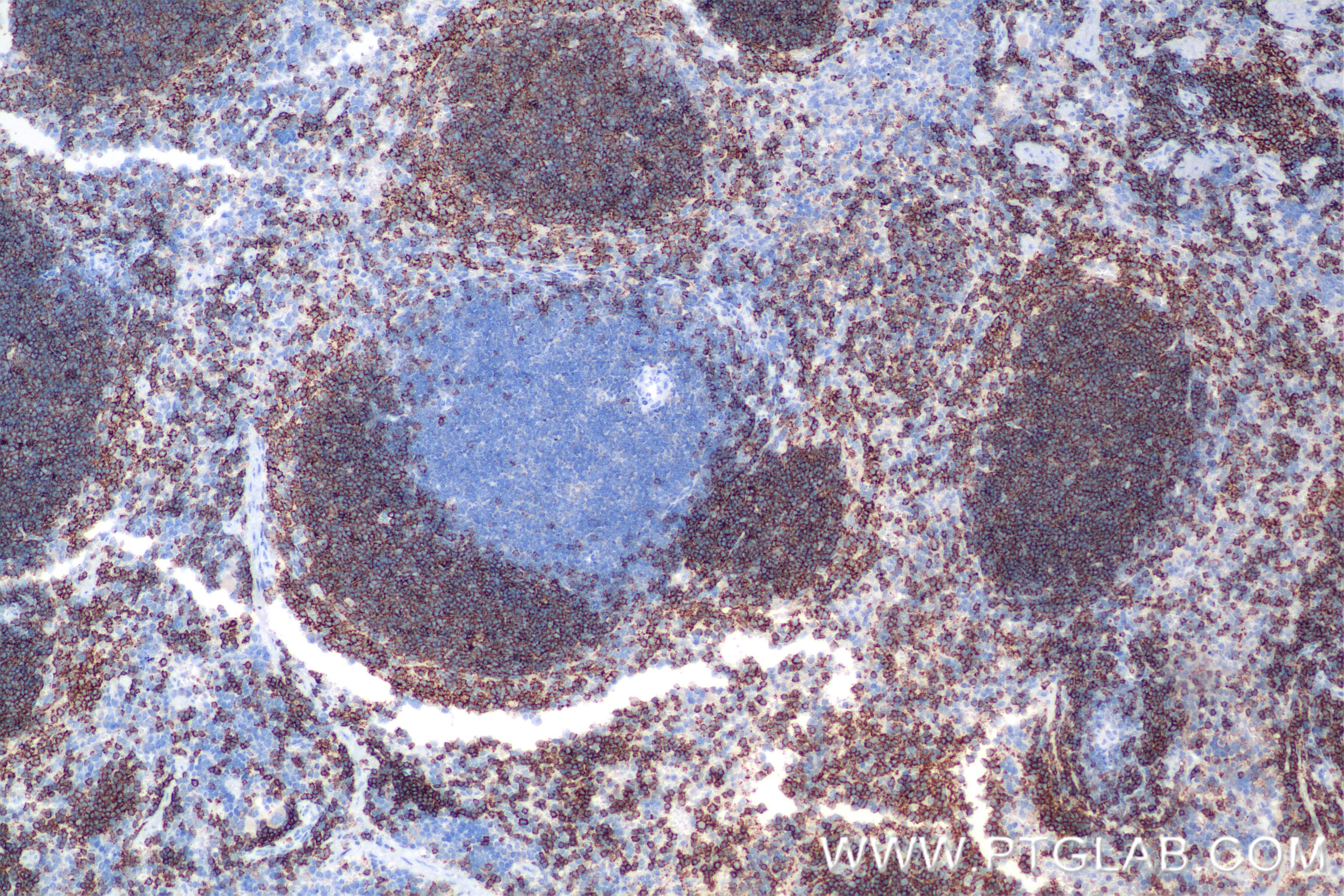 Immunohistochemistry (IHC) staining of mouse spleen tissue using CD37 Recombinant antibody (85917-1-RR)