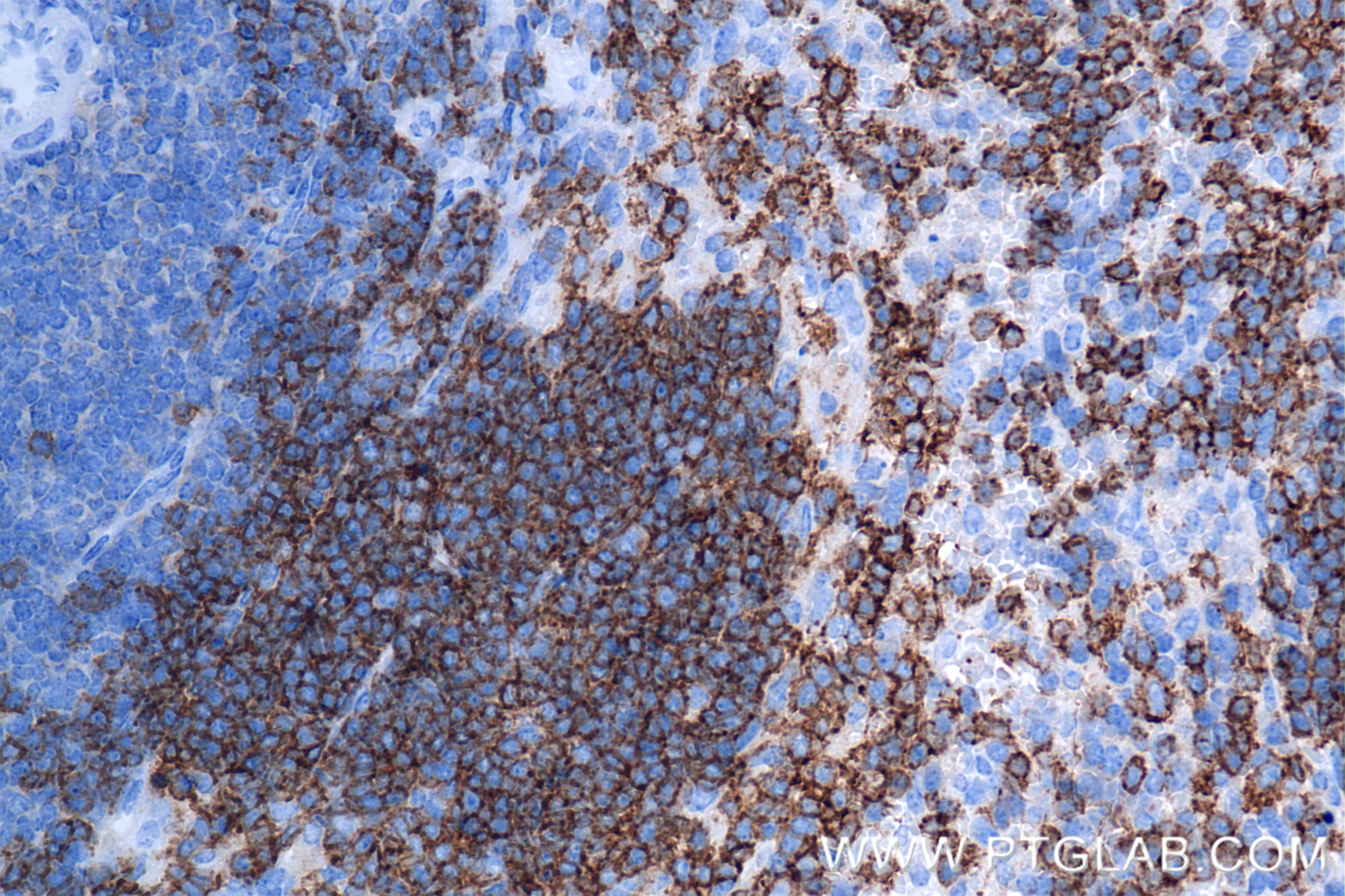 Immunohistochemistry (IHC) staining of mouse spleen tissue using CD37 Recombinant antibody (85917-1-RR)