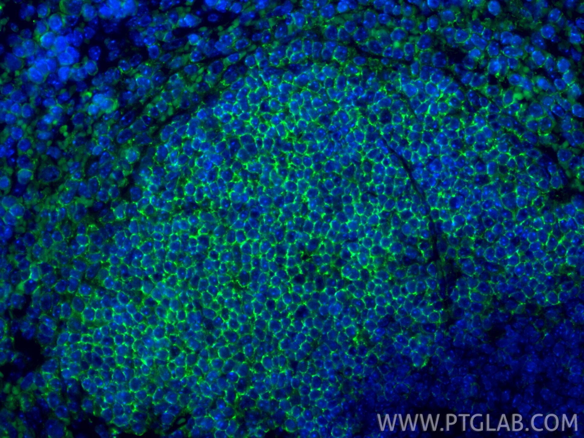 Immunofluorescence (IF) / fluorescent staining of mouse spleen tissue using CoraLite® Plus 488-conjugated CD37 Recombinant mon (CL488-85917)