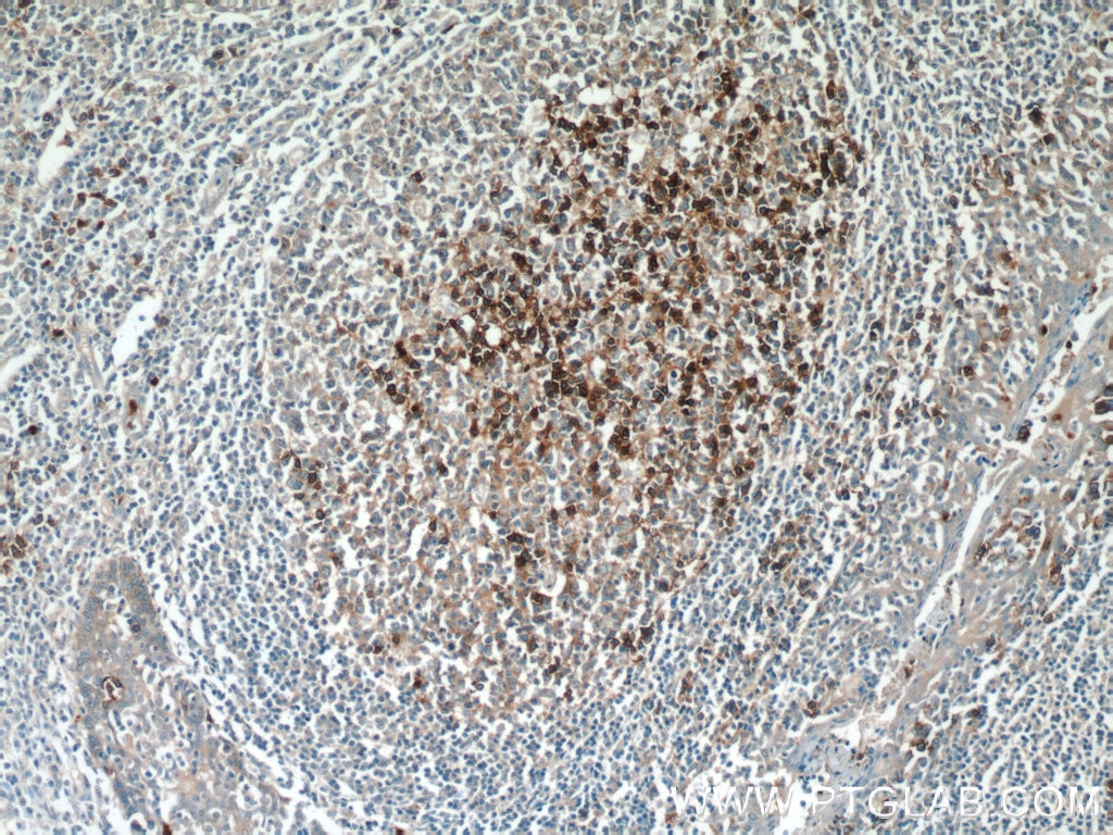 CD38 Polyclonal antibody